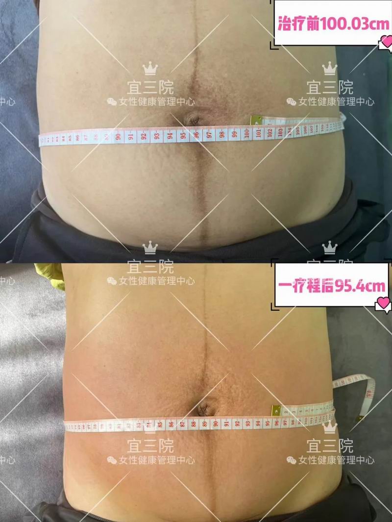 640_wx_fmt=png&from=appmsg&tp=webp&wxfrom=5&wx_lazy=1&wx_co=1 (4)