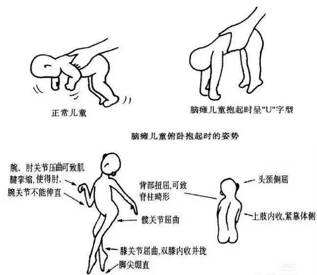 640_wx_fmt=png&from=appmsg&tp=webp&wxfrom=5&wx_lazy=1&wx_co=1_副本