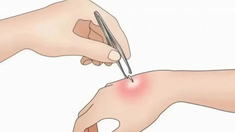 640_wx_fmt=png&from=appmsg&tp=webp&wxfrom=5&wx_lazy=1 (10)