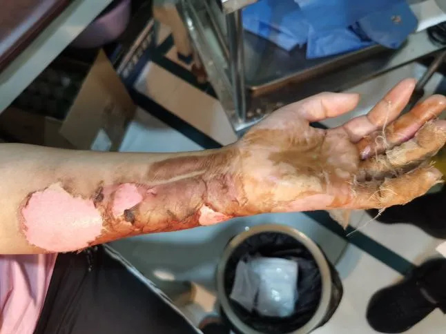 640_wx_fmt=png&from=appmsg&tp=webp&wxfrom=5&wx_lazy=1 (11)