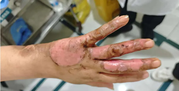 640_wx_fmt=png&from=appmsg&tp=webp&wxfrom=5&wx_lazy=1 (12)